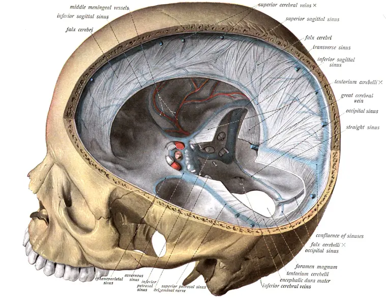 Ilustração anatómica do crânio humano em secção lateral, mostrando a cavidade craniana com a dura-máter, os seios venosos, as veias cerebrais e os ossos cranianos envolventes.
